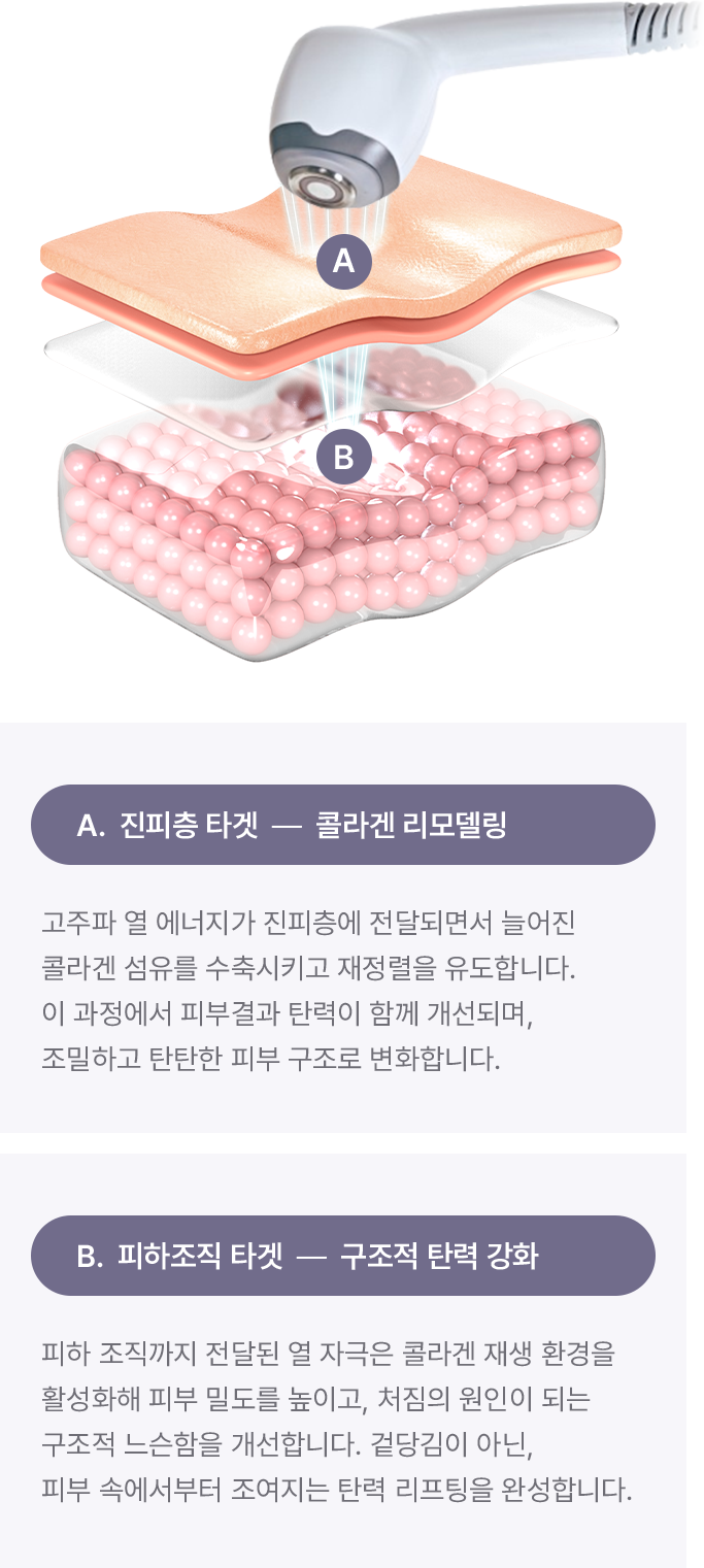 논현 피부과 올타이트 효과 설명 이미지