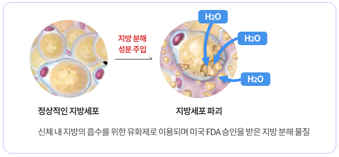 강남 논현 피부과 루아크 바디 디센바
