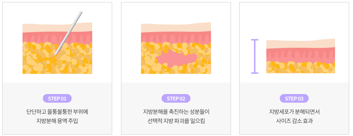 강남 논현 피부과 루아크 슬림핏 피부 표현 예시